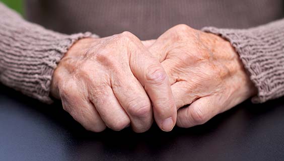 Osteoarthritis : National Institute on Aging